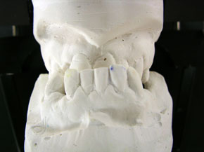 teeth models