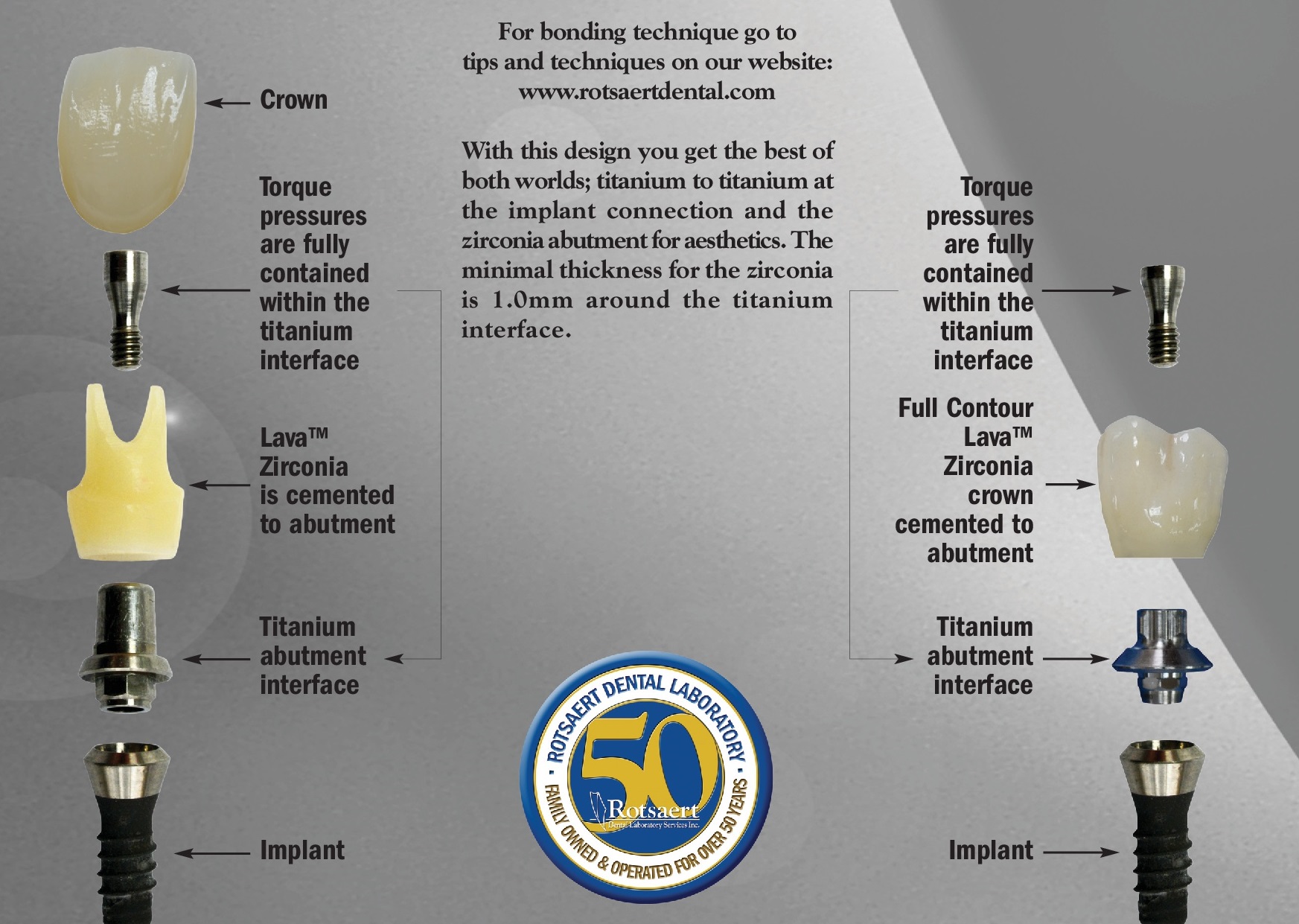 Dental Implant Restorations Rotsaert Dental Laboratory