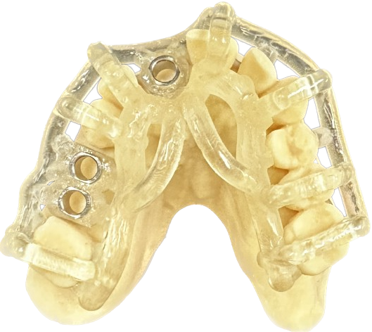 Kc Rotsaert Implant Placement Guides | Rotsaert Dental Laboratory