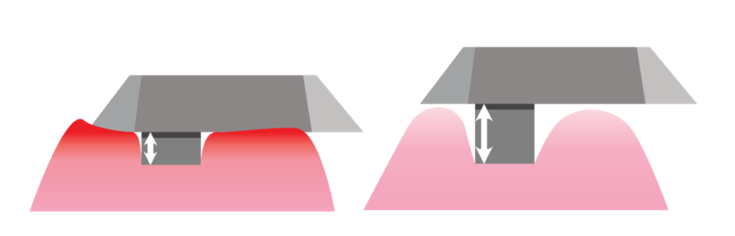 Gauges Height Limit